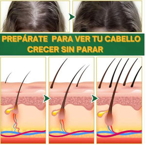 OUHOE - CRECIMIENTO Y CONTROL DE CAIDA DEL CABELLO