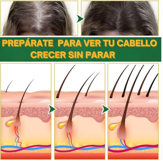 OUHOE - CRECIMIENTO Y CONTROL DE CAIDA DEL CABELLO