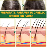 OUHOE - CRECIMIENTO Y CONTROL DE CAIDA DEL CABELLO